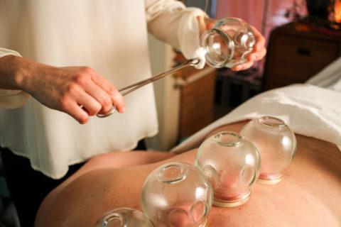 cupping Zócalo Wellness Acupuncture in Portland, OR